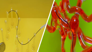 Magnetically Controlled Robotic Thread Can Actively Glide Through the Brain’s Blood Vessels 103 Magnetically Controlled Robotic Thread Can Actively Glide Through the Brain’s Blood Vessels