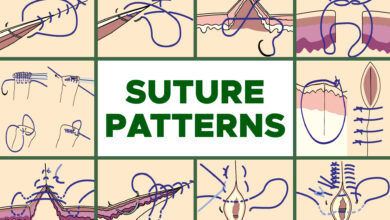 Common Suture Patterns 102 Common Suture Patterns: Interrupted, Continuous, Appositional, Inverting, Tension and Others