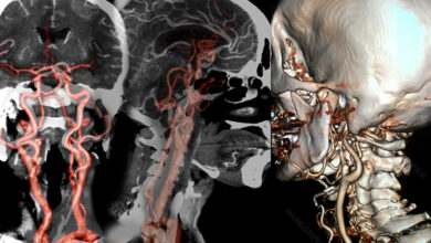 New Vascular Contrast Presents a 'Clearer Picture’ of Blood Vessels in Health and Disease 40 New Vascular Contrast Presents a 'Clearer Picture’ of Blood Vessels in Health and Disease
