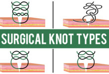 Common Surgical Knot Types 68 Surgical Knot Types surgical knot techniques
